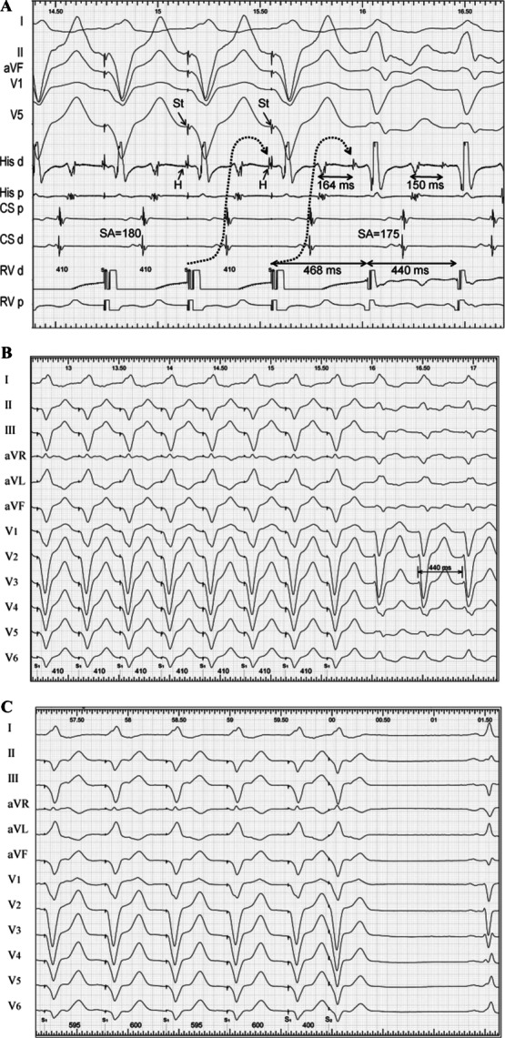 Figure 18