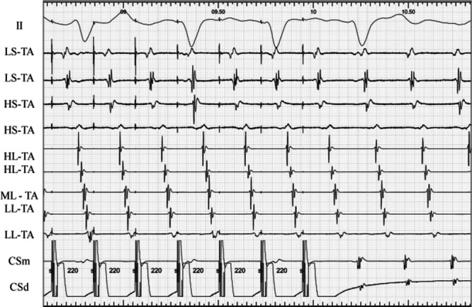 Figure 17