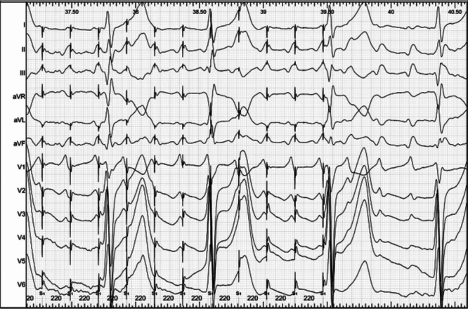 Figure 10