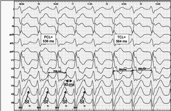 Figure 21