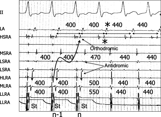 Figure 15