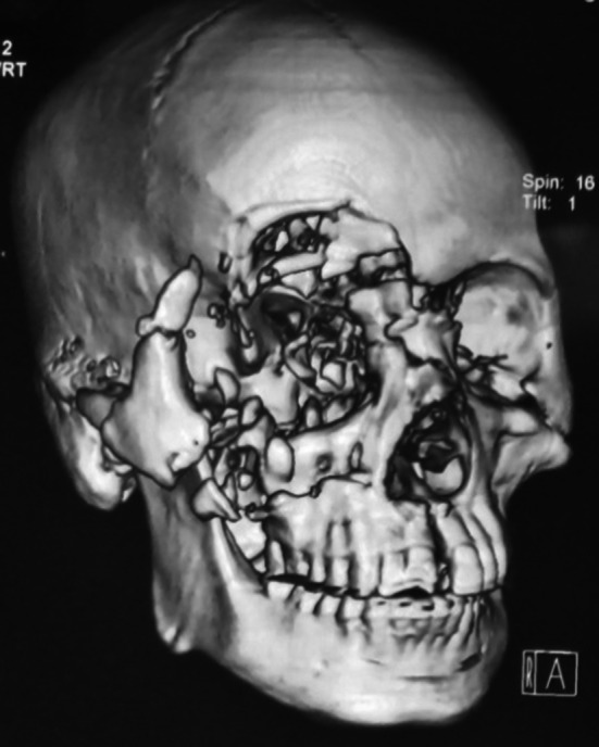 Fig. 4