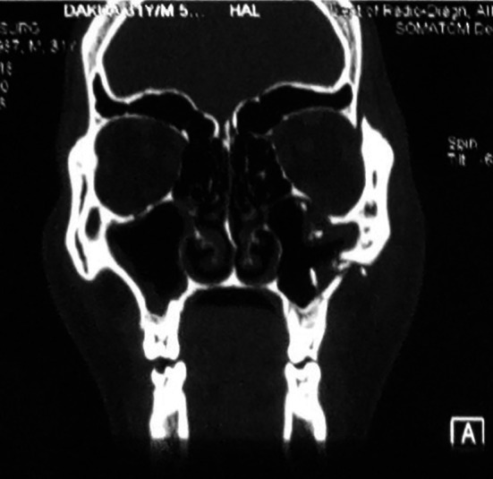 Fig. 6