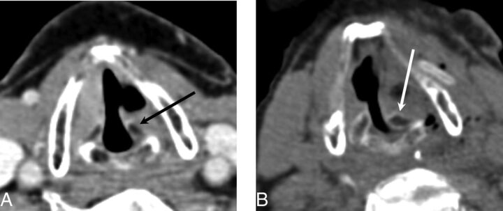 Fig 11.