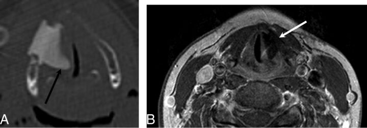 Fig 7.