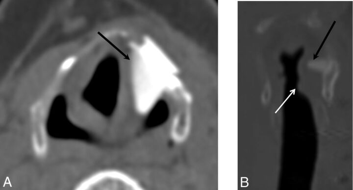 Fig 10.