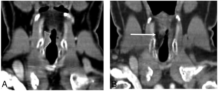 Fig 5.