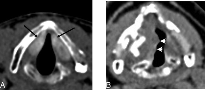 Fig 6.