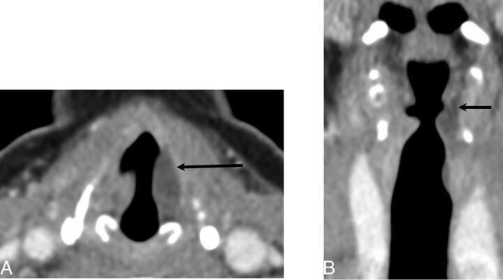 Fig 2.