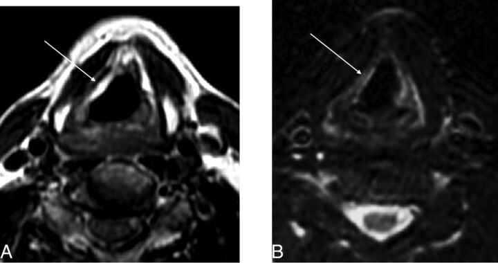 Fig 3.