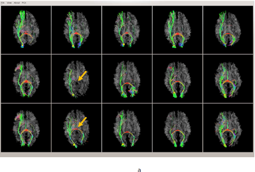 Fig.2