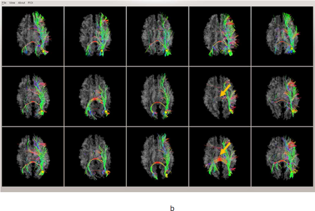 Fig.2