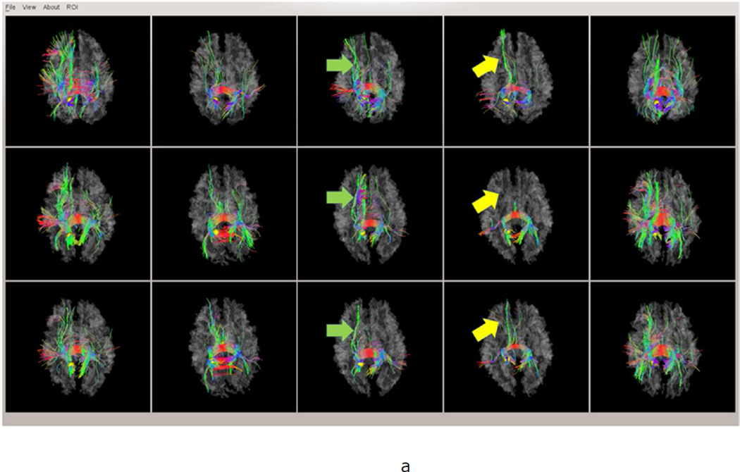 Fig.3