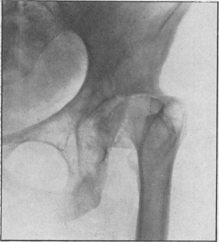 Fig. 12