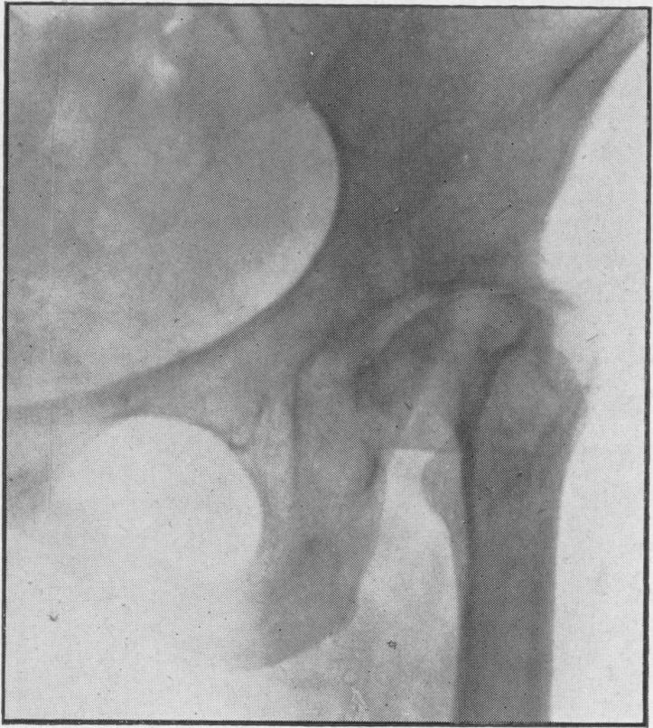 Fig. 13