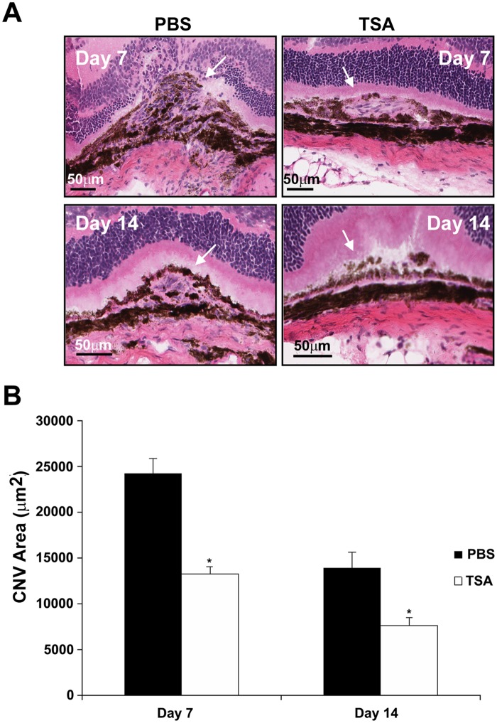 Fig 12