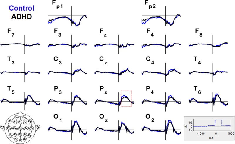 Fig 2