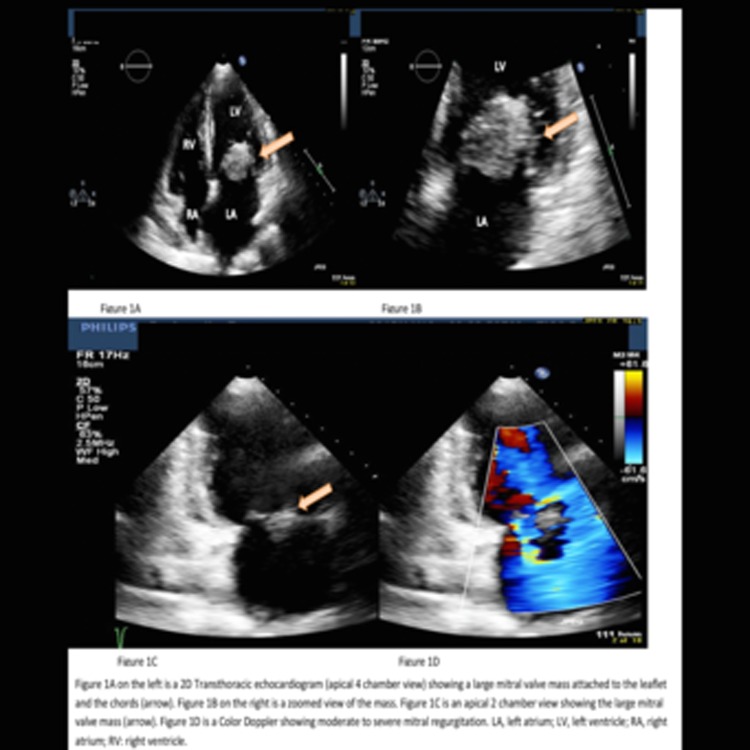 Figure 1