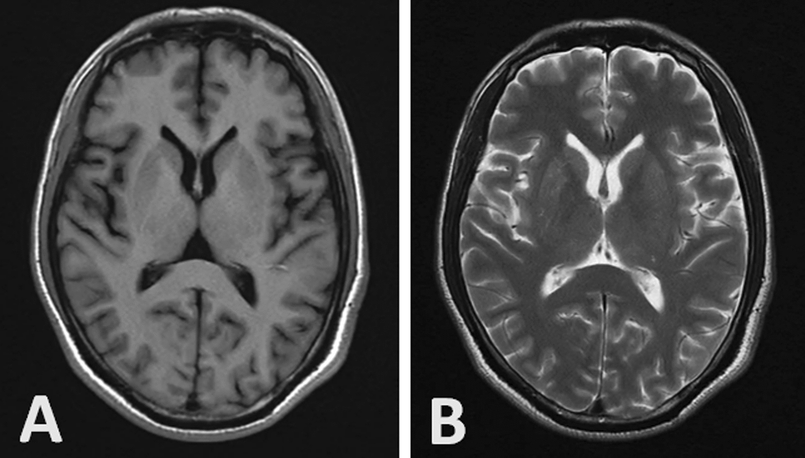 Fig. 1