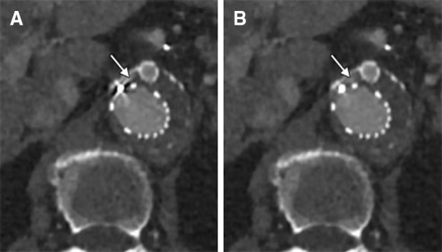 Fig. 6