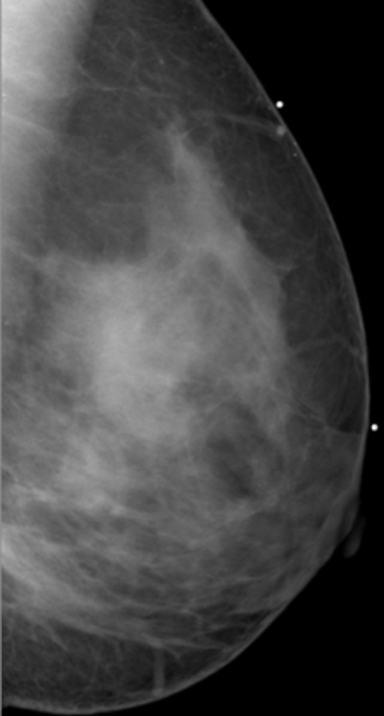 Figure 1c: