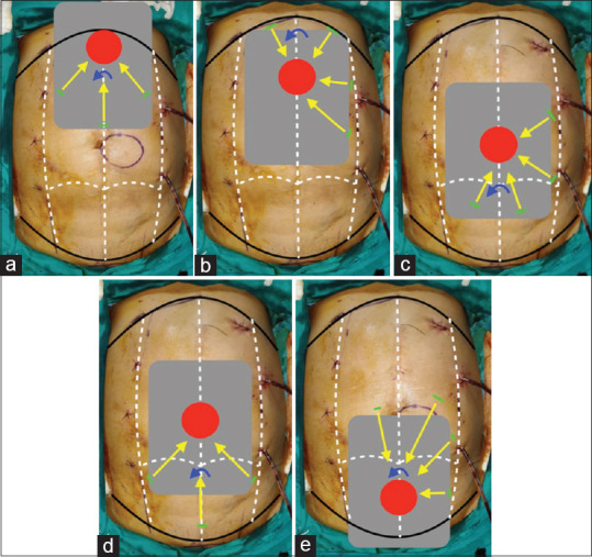 Figure 14