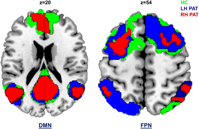 FIGURE 3