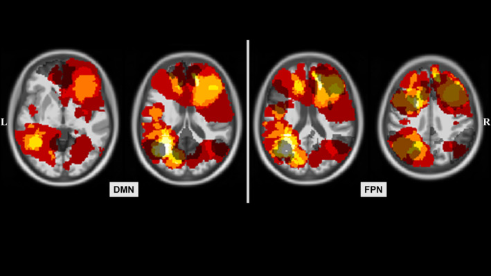 FIGURE 2