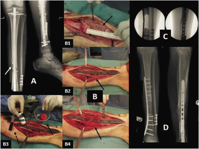 Fig. 3