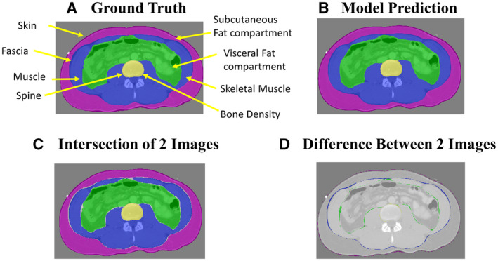 FIG. 1