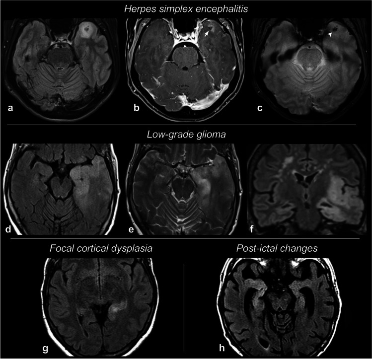 Fig. 6