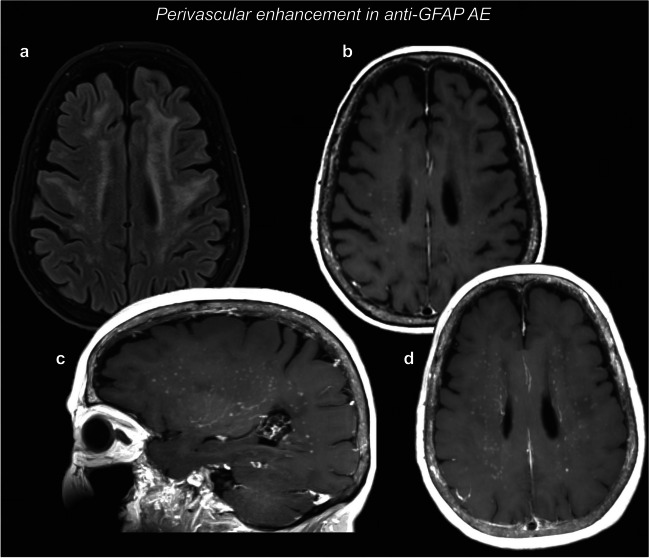 Fig. 5