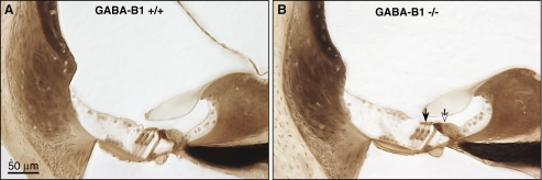 FIG. 5