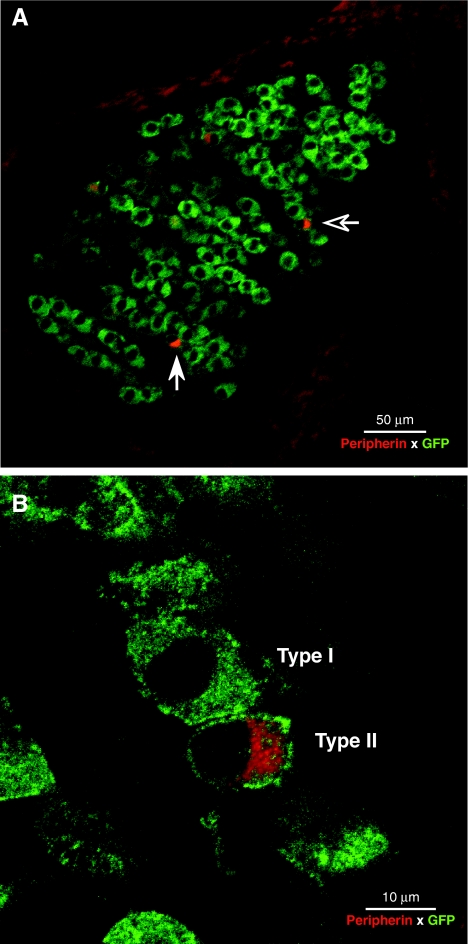 FIG. 1