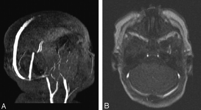 Fig 3.