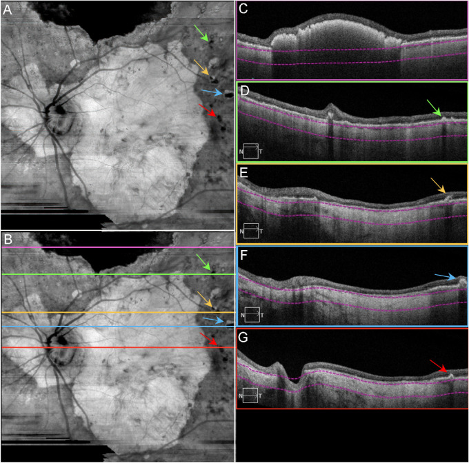 Figure 3.