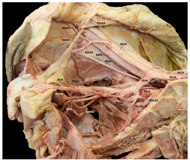 Figure 11