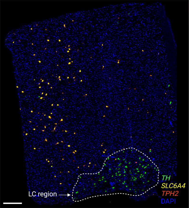 Figure 3—figure supplement 11.