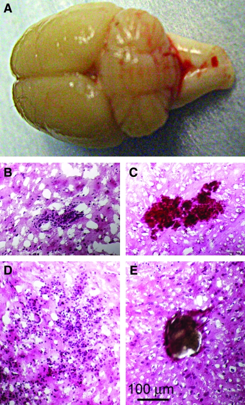 FIG. 4.