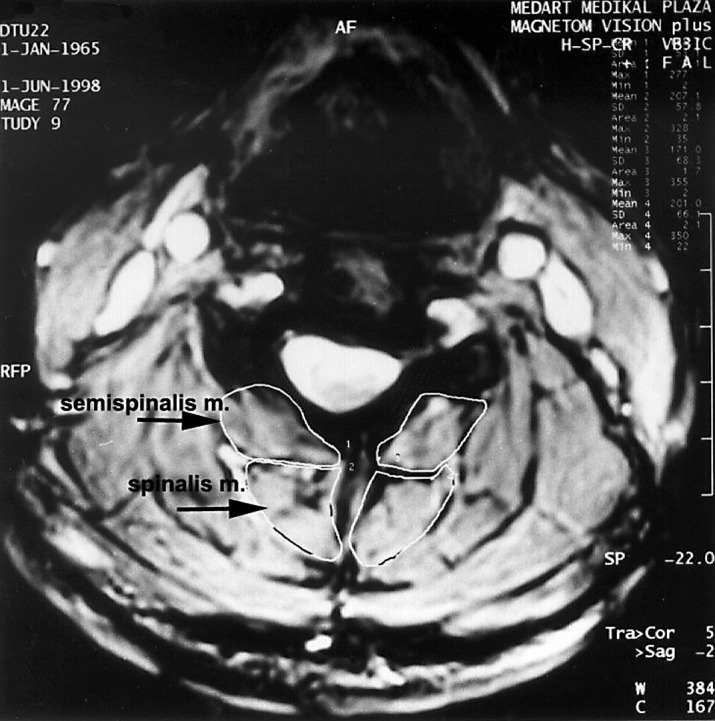 Fig. 2