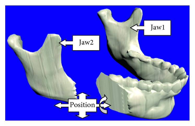 Figure 11