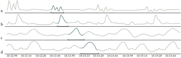 Fig 3
