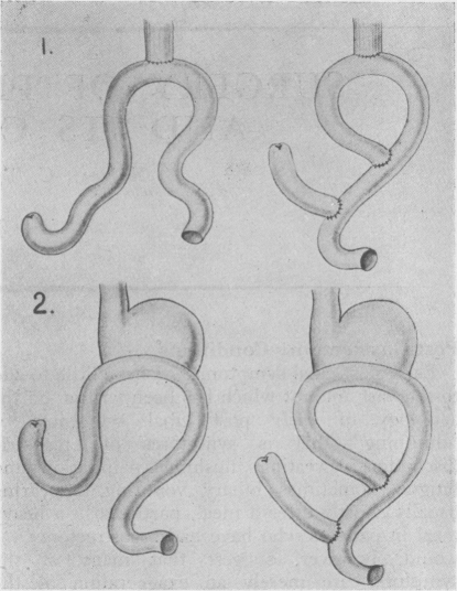 Fig. 17