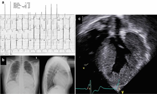 Fig. 1