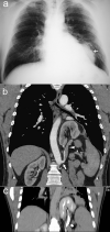Fig. 1