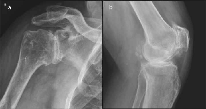 Figure 2. a, b