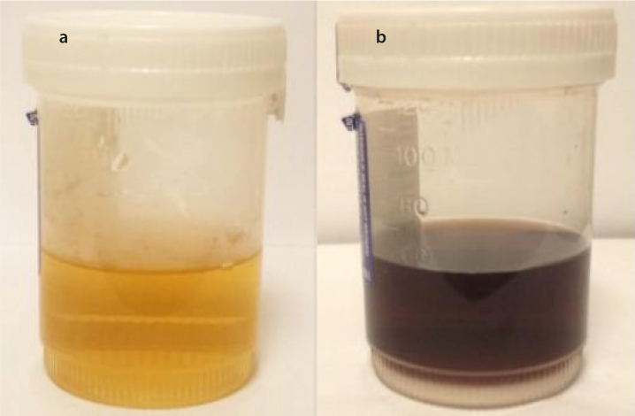 Figure 1. a, b