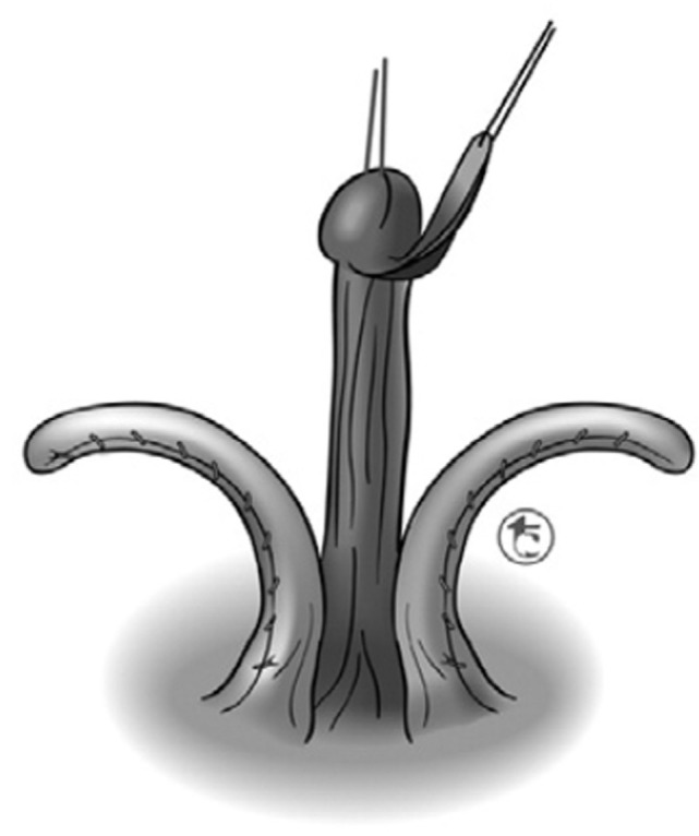 Figure 11
