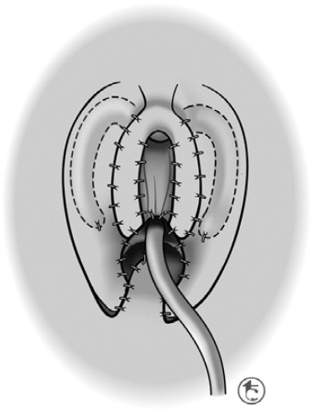Figure 12