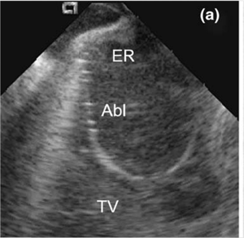 Fig. (1)